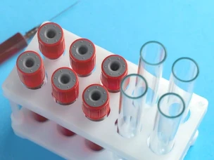 О диагностике ВИЧ-инфекции и профилактике