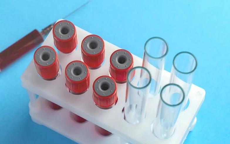 О диагностике ВИЧ-инфекции и профилактике