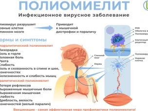 Полиомиелит